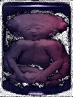 p2.gif